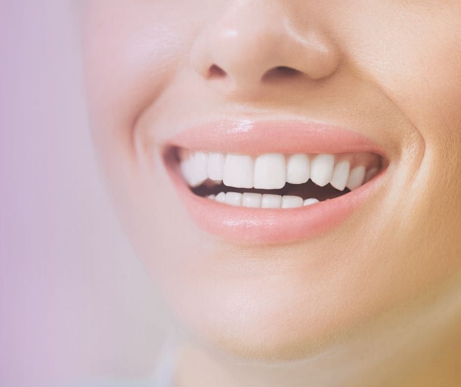 periodontal maintenance | woman smiling